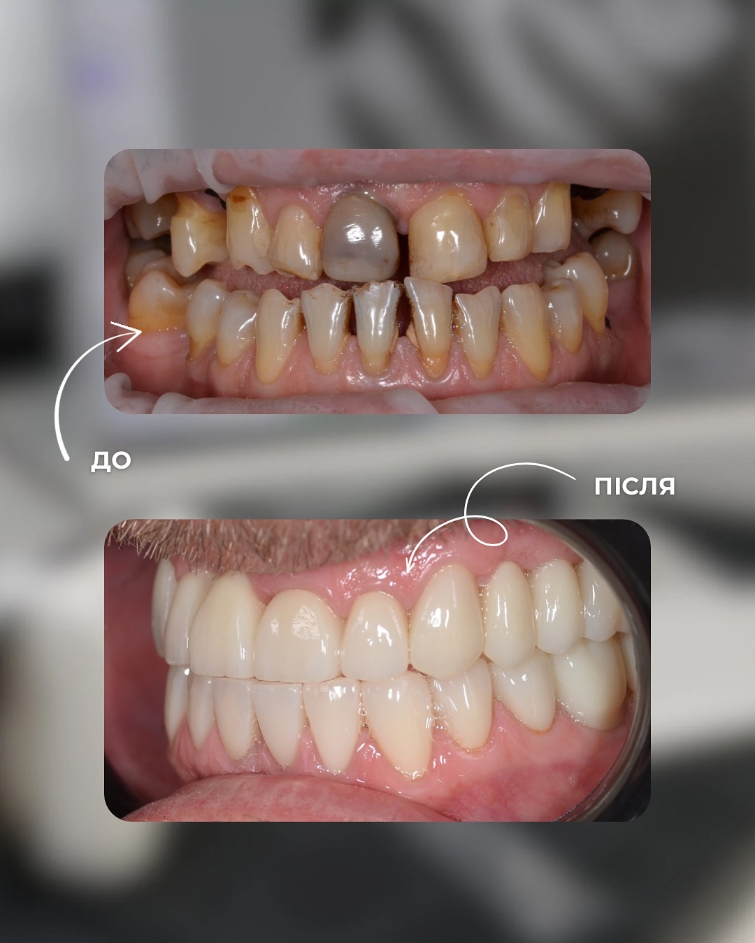 Клінічні кейси