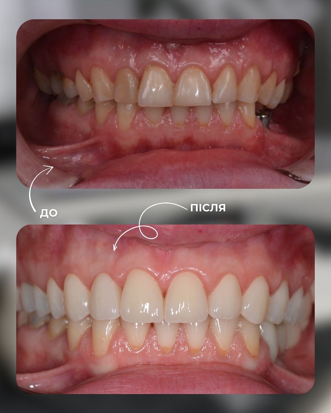 Клінічні кейси