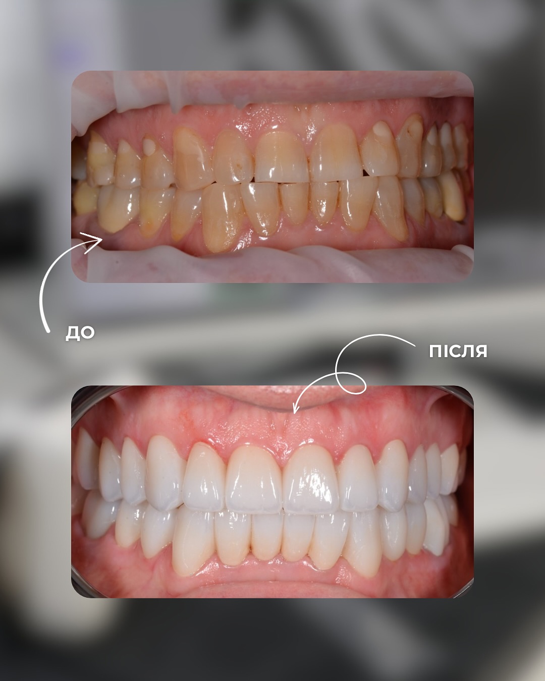 Клінічні кейси