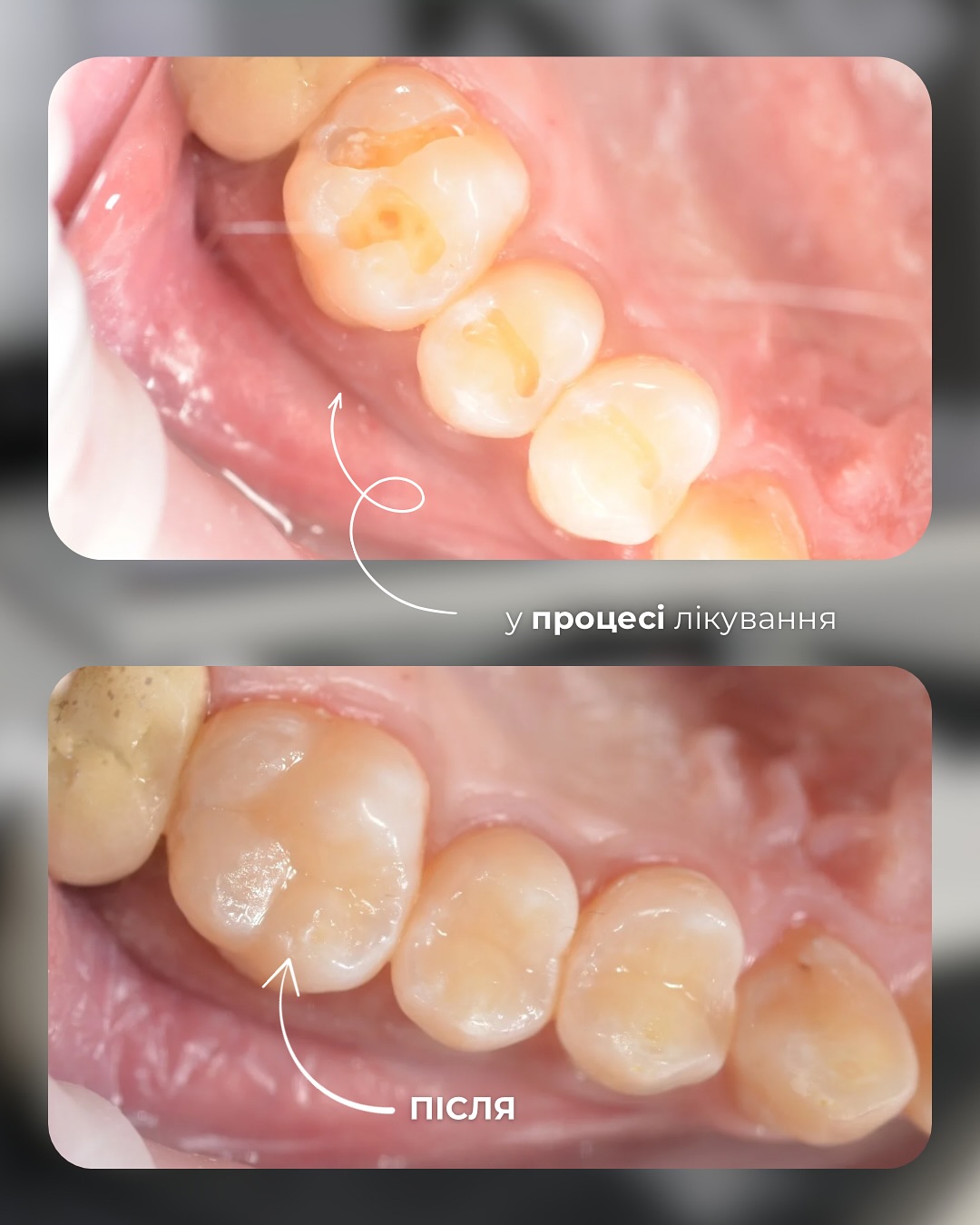 Клінічні кейси