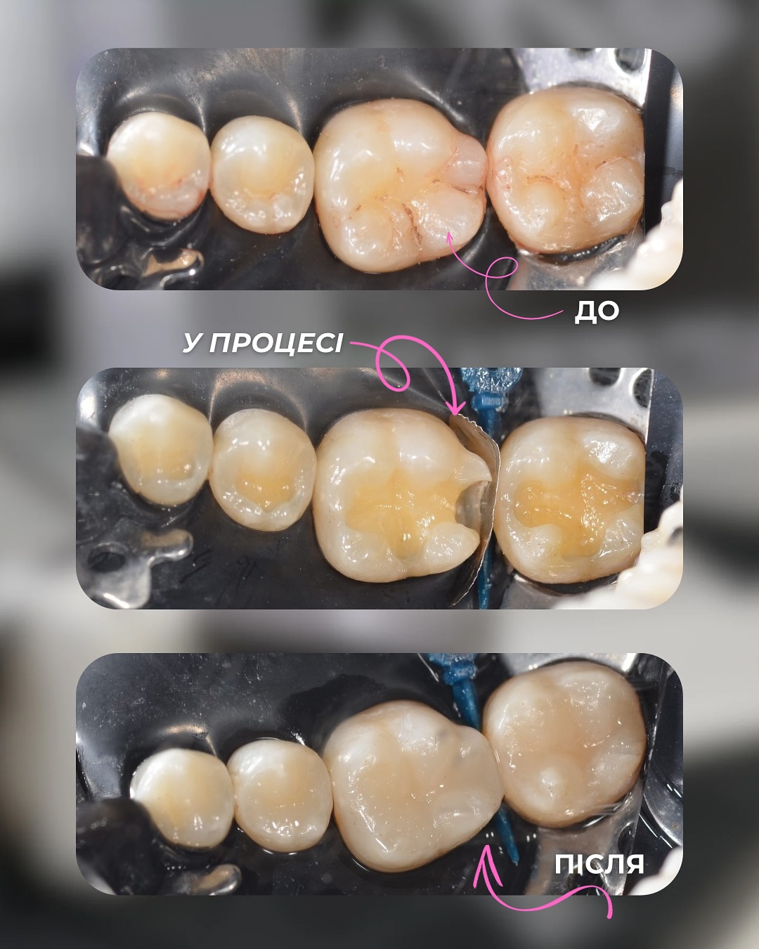 Клінічні кейси