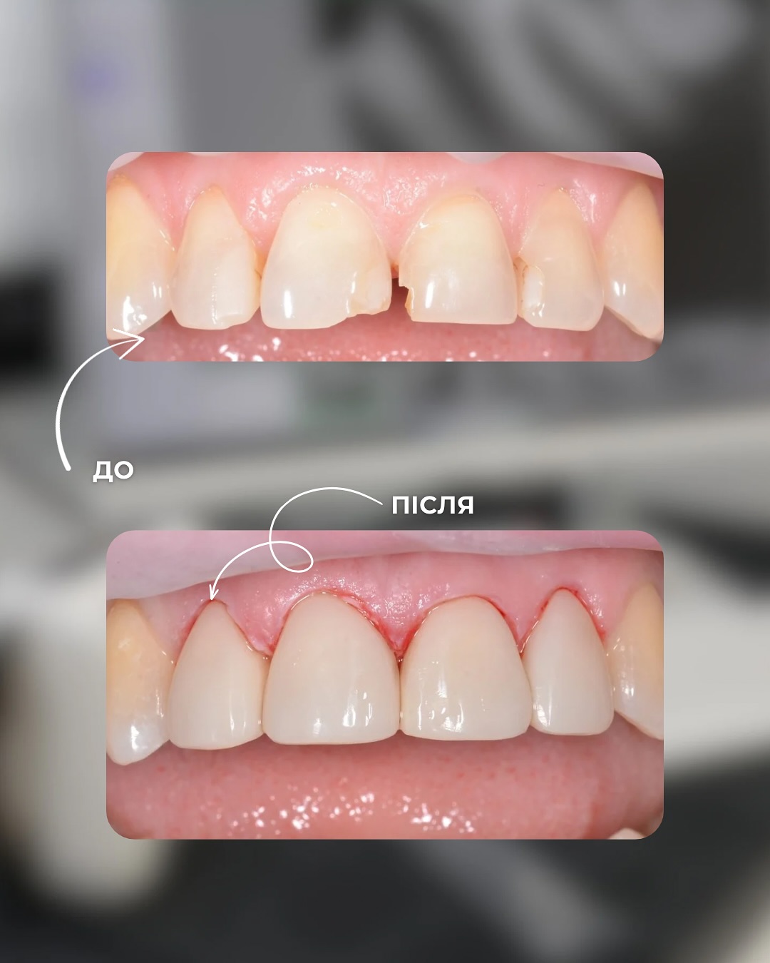 Клінічні кейси